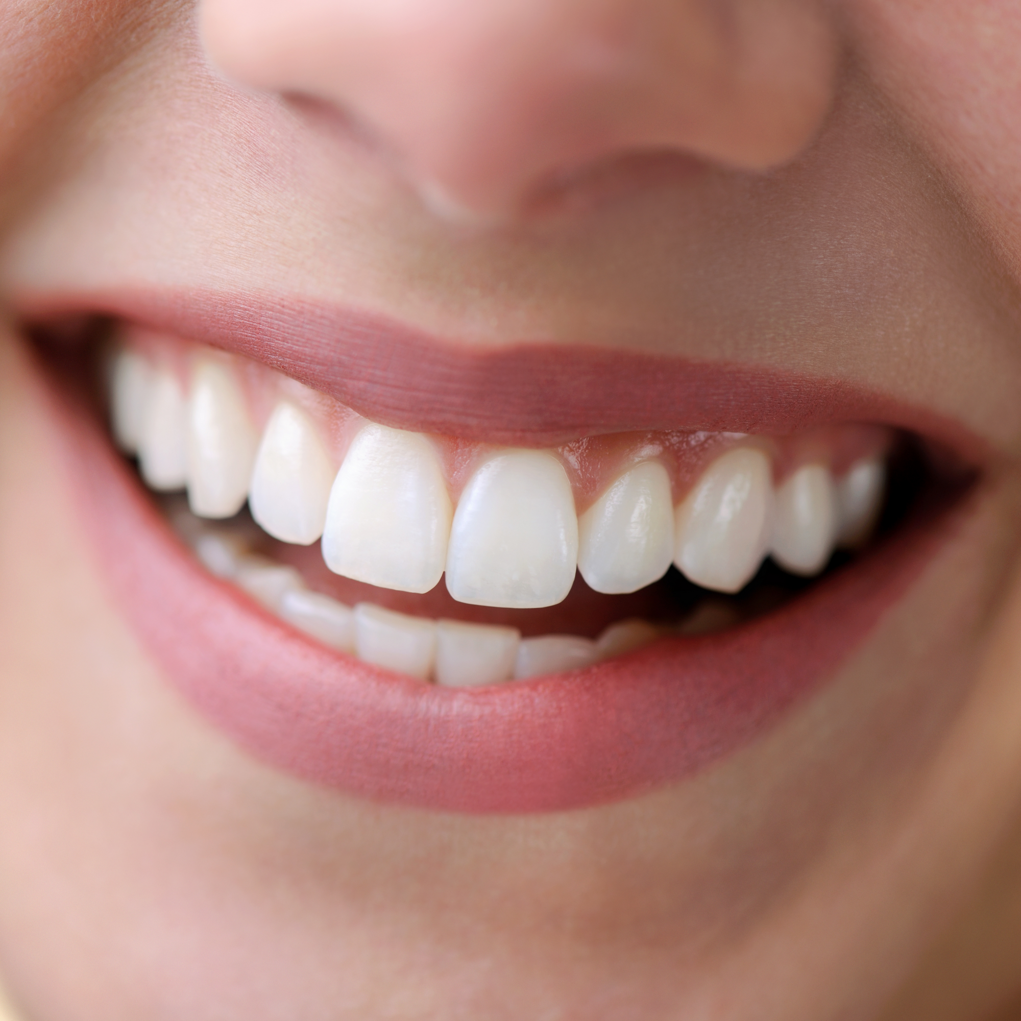 Philips Zoom NiteWhite – Blanqueamiento Dental Profesional x Unidad